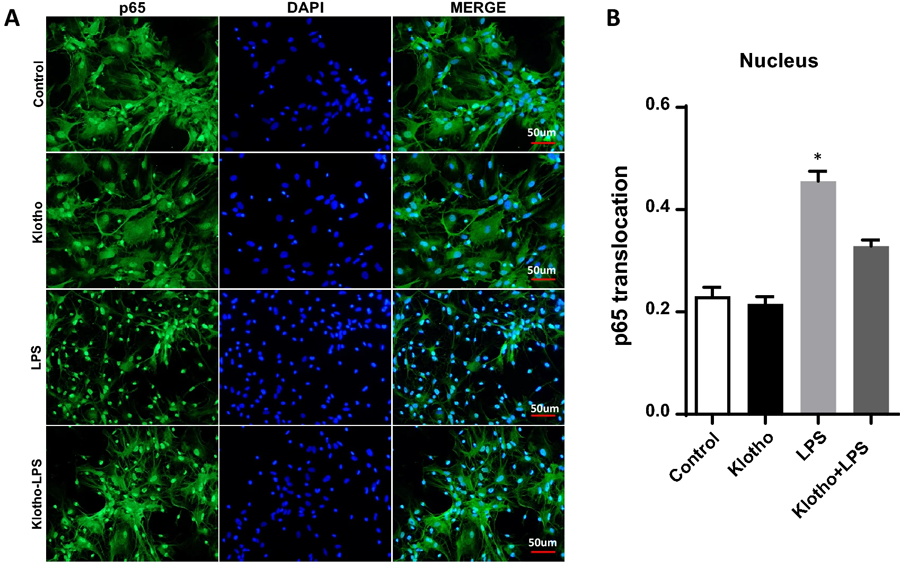 α-Klotho挽救核心區域由LPS誘導的NF-κB活化 α-Klotho挽救核心區域由LPS誘導的NF-κB活化