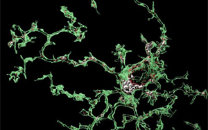 Nature子刊：血管周圍細胞誘發阿爾茨海默病相關的微膠質功能障礙