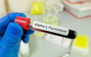 α-L-巖藻糖苷酶(AFU)檢測試劑盒用原輔料