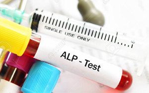 堿性磷酸酶(ALP/AKP)檢測試劑盒用原輔料