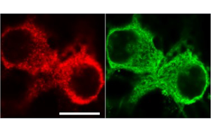 《PNAS》從過度反應蛋白合成到認知障礙,敲除1個基因即可