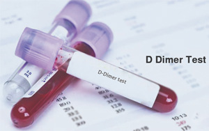 D-二聚體（D-Dimer）-磁微粒化學發光法（吖啶酯） /熒光免疫層析解決方案