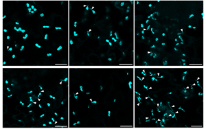 Science Advances：葉綠體的作用不僅僅是光合作用！免疫防御中隱藏的玩家