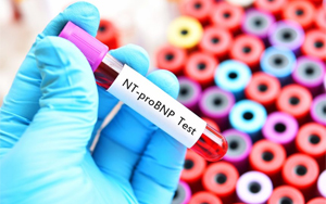 氨基末端腦利鈉肽前體（NT-proBNP）-熒光免疫層析解決方案