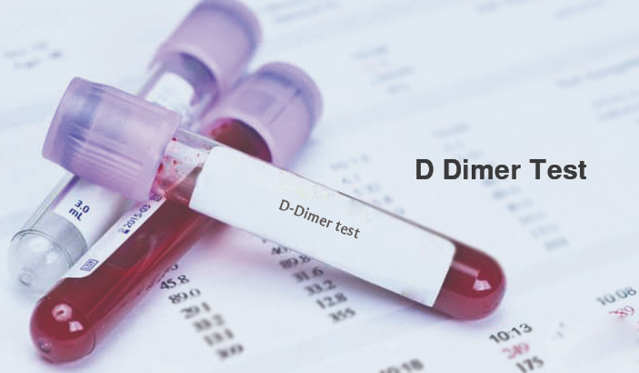 D-二聚體（D-Dimer）-磁微粒化學法學發(fā)光（AP/AE） /熒光免疫層析解決方案