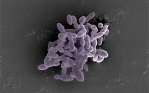 Science Immunology：一種腸道細菌可以增強免疫反應，增強癌癥免疫治療